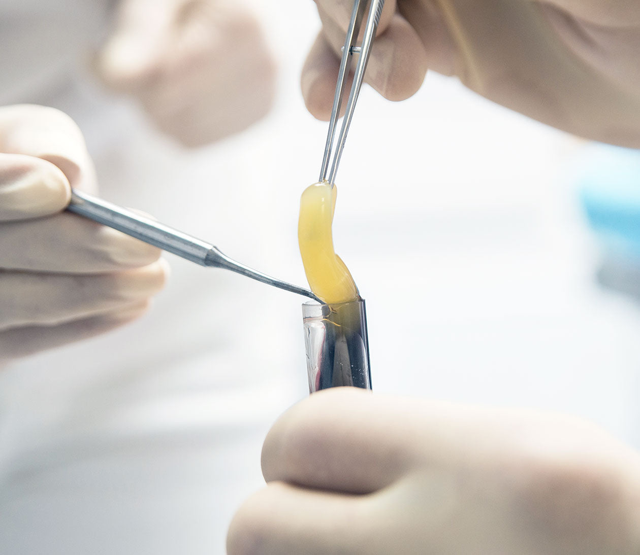 PRF Treatment | Platelet-Rich Fibrin Skin and Dental – Integrity PRP